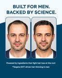 Improved Complex Saw Palmetto for Men 900 mg
